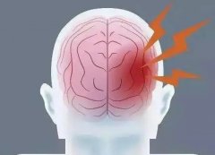 頭痛欲裂感覺要爆炸了怎么辦？